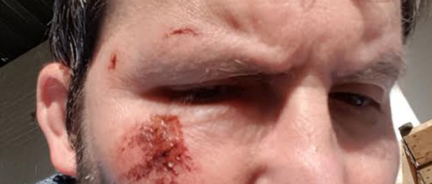 jos van bracht - esch gelanceerd rolstoel Rolstoeler Jos van Bragt maakte een selfie na zijn ongeval in Esch © Jos van Bragt